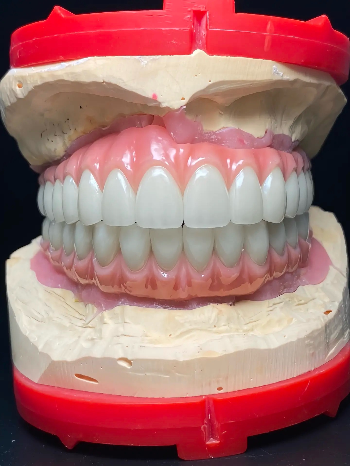 生活攻略-义齿出口供应商 假牙供应商 牙科产品供应商(1)