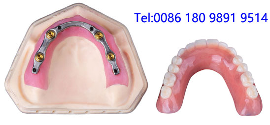 生活攻略-义齿出口代理 假牙出口代理 牙科产品出口代理 义齿贸易...(1)