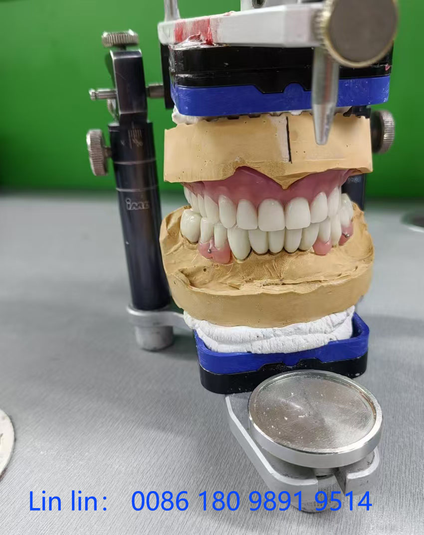 生活攻略-义齿出口义齿出口合作代理 义齿出口渠道代理 义齿...(1)