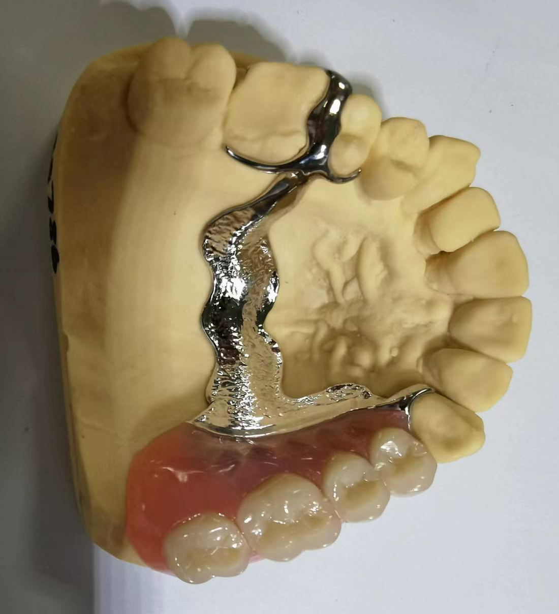 生活攻略-中国义齿加工厂 义齿定制服务 义齿加工合作 专业义齿生...(1)